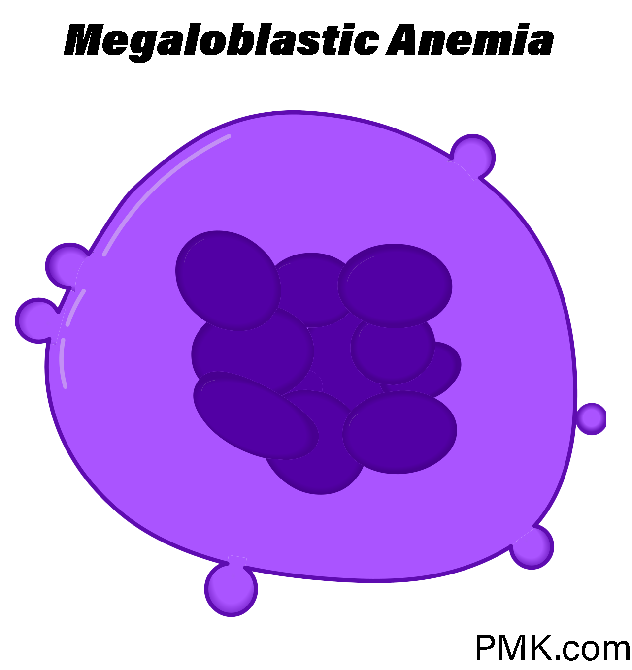 megaloblastic anemia