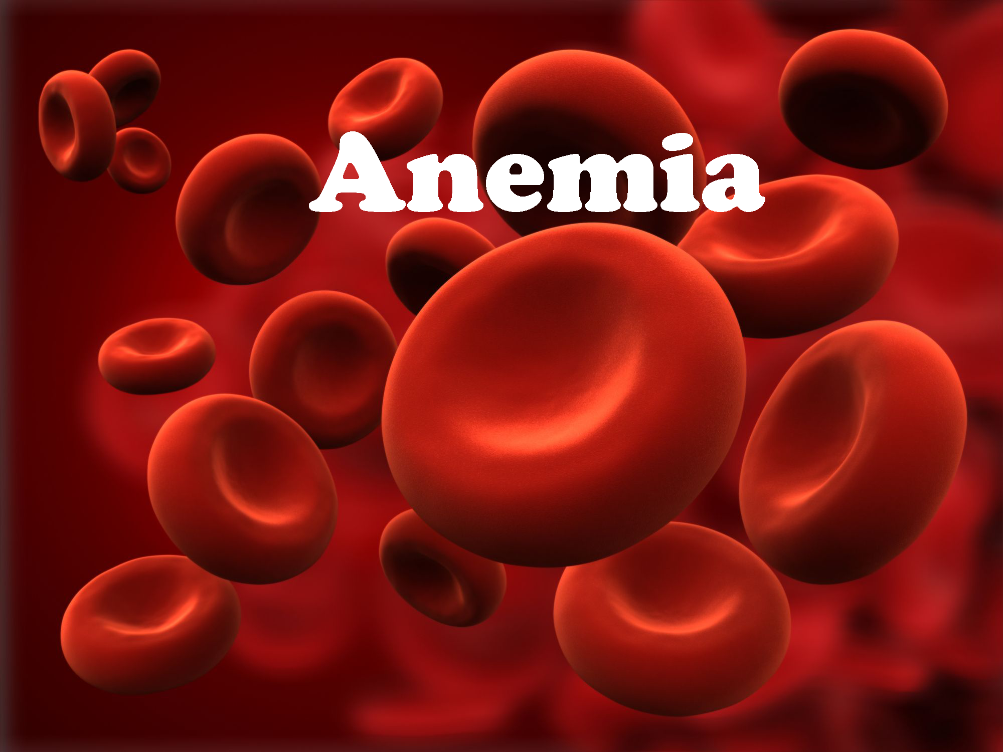 anemia